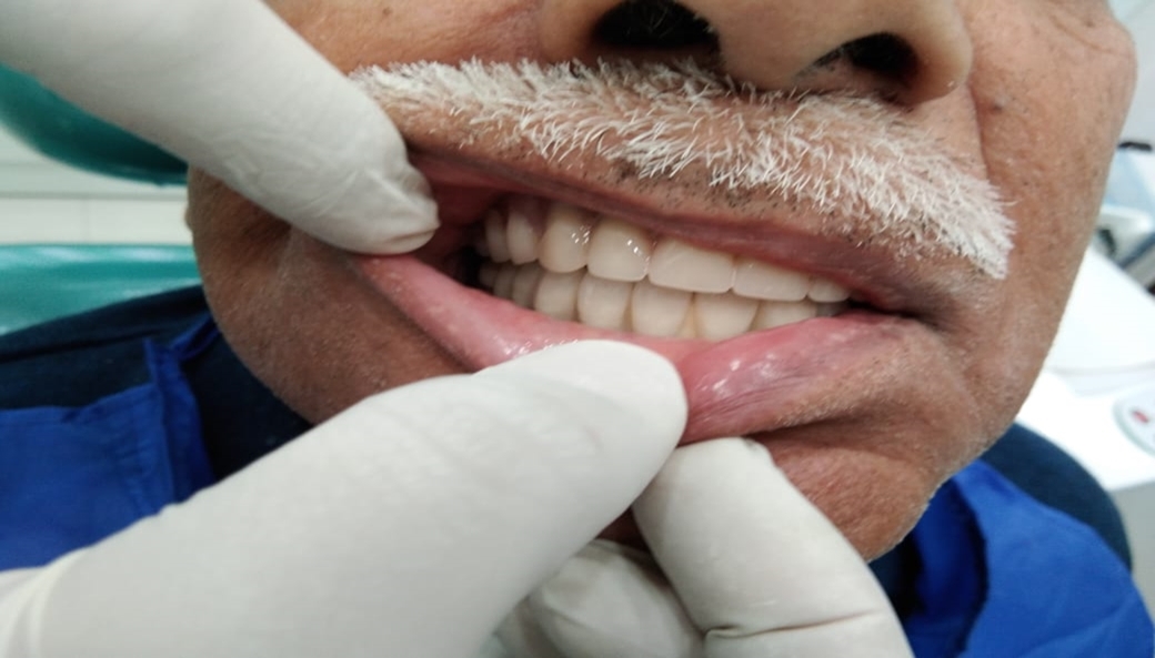 Dental clinic Delhi