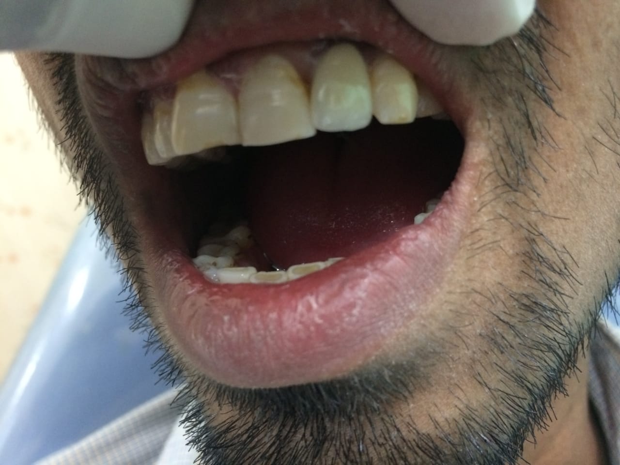 Dental clinic Delhi