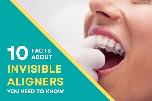 10 facts about invisible aligners you need to know