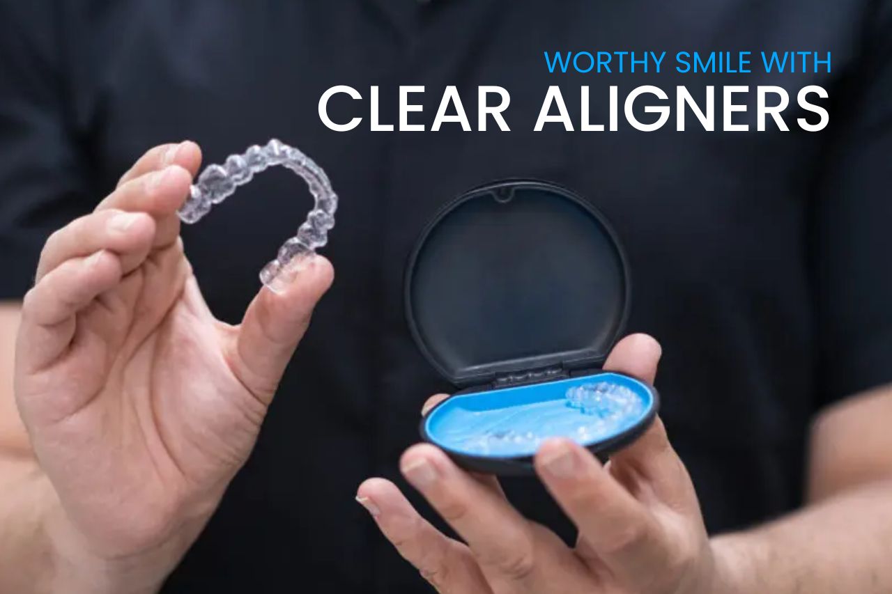 Achieving-an-Instagram-Worthy-Smile-with-Clear-Aligners