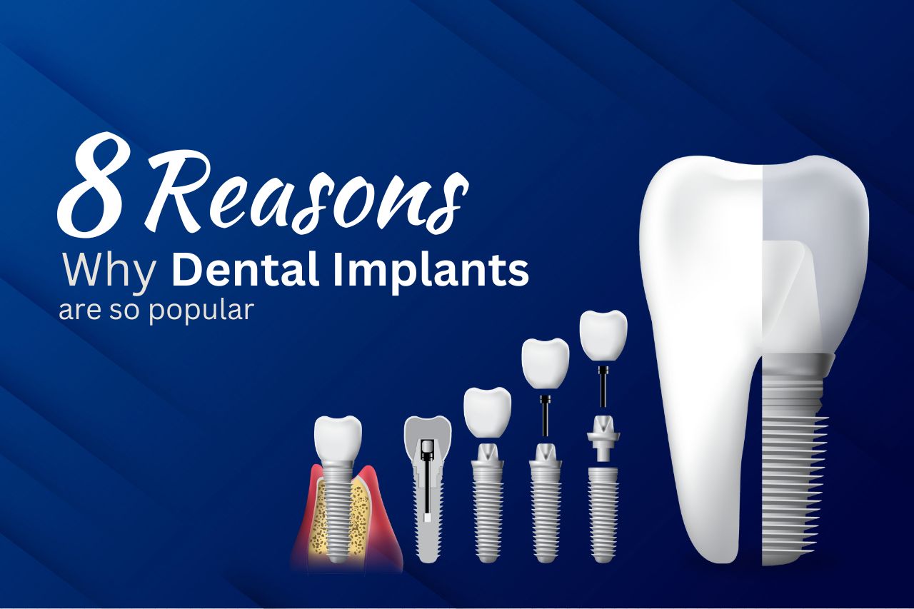 8 Reasons Why Dental Implants Are So Popular