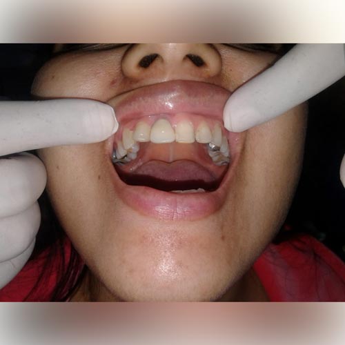 smritiraj dentistry
