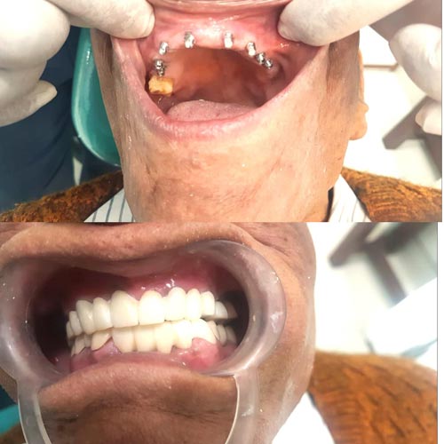 smritiraj dentistry
