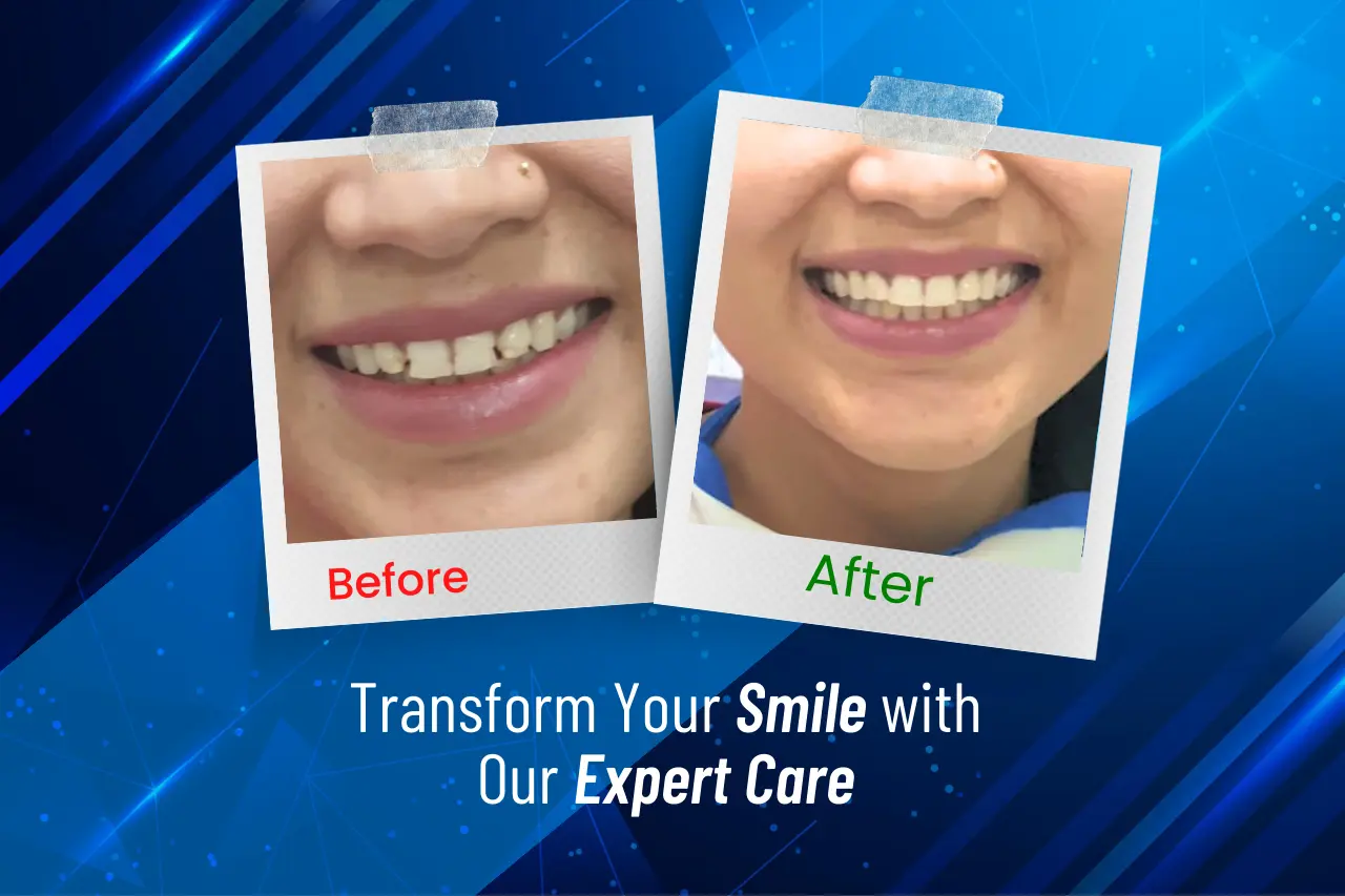 Transform Your Smile with Our Expert Care