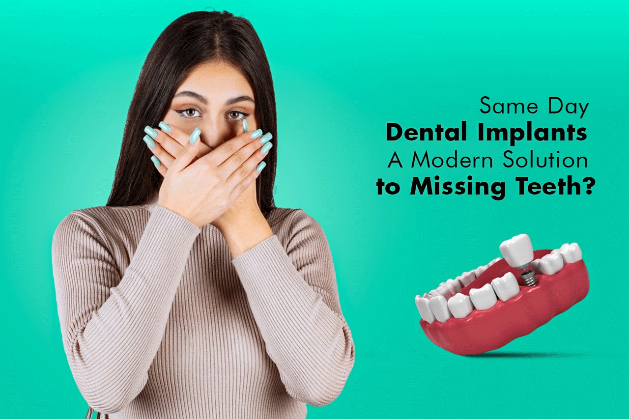 Same Day Dental Implants A Modern Solution to Missing Teeth?